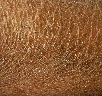 Comment reconnaître une peau déshydratée ?
