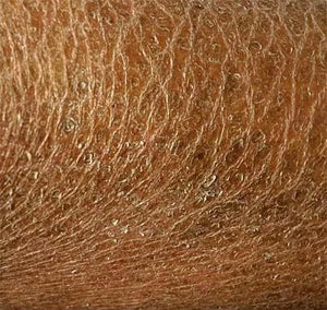 Comment reconnaître une peau déshydratée ?